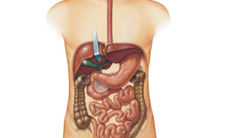 Recurrent Diseases